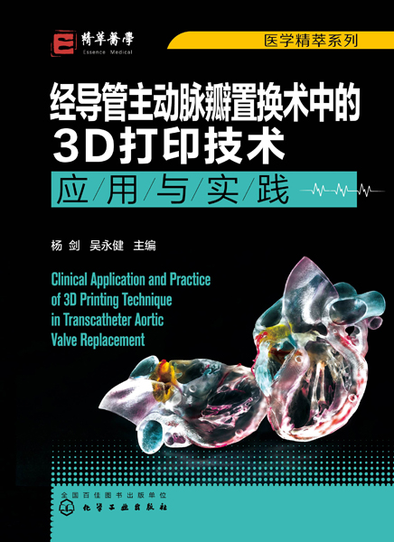 医学精萃系列--经导管主动脉瓣置换术中的3D打印技术——应用与实践